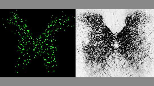 Study Shows Possible Breakthrough in Treating Paralysis