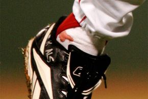 A blood stain shows on the sock of Boston Red Sox pitcher Curt Schilling as he pitches against the St. Louis Cardinals in the first inning of Game 2 of the World Series at Fenway Park in Boston, 2004. Detractors said the stain was really ketchup.