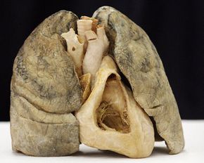 Not exactly peak performance -- a smoker's dissected heart and lungs were displayed in Mexico City in 2006 to kick off the opening of the exhibit "The Human Body."”width=