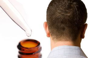 Man's scalp and amber bottle and dropper of clear liquid.