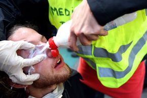Medics wash a protester's eyes after police sprayed tear gas into a crowd demonstrating during the NATO summit on April 4, 2009, in Strasbourg, France.