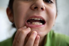 teeth falling out