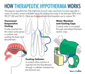 Methods for inducing therapeutic hypothermia