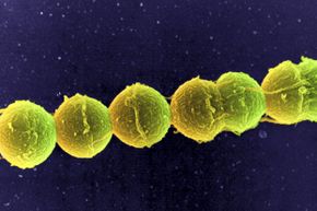 Streptococcus bacteria, pictured here at high magnification, is estimated to be on almost half of all toilet seats.