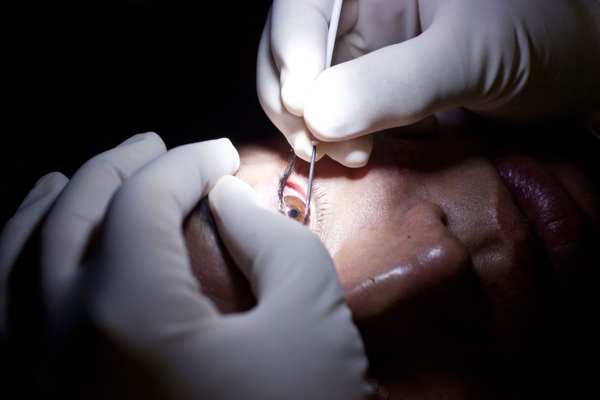 How Tooth-in-Eye Surgery Works