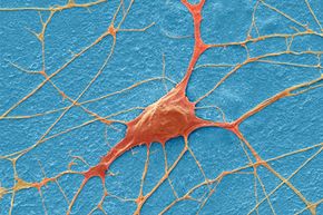 We are already transplanting neurons -- and there might be more breakthroughs on the horizon.