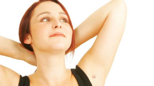 How to Treat an Underarm Cyst