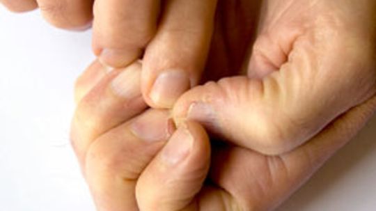 How to Treat Cracked Nails