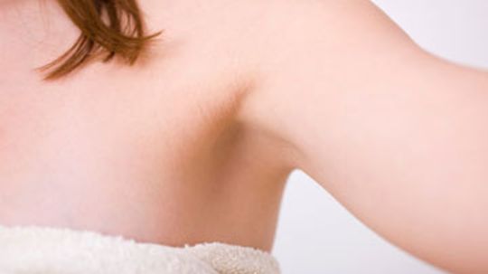 How to Treat Underarm Ingrown Hairs