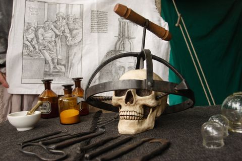 You Need It Like a Hole in the Head: The Ancient Medical Art of Trepanation - Vimarsana News