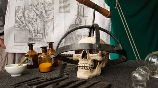 You Need It Like a Hole in the Head: The Ancient Medical Art of Trepanation