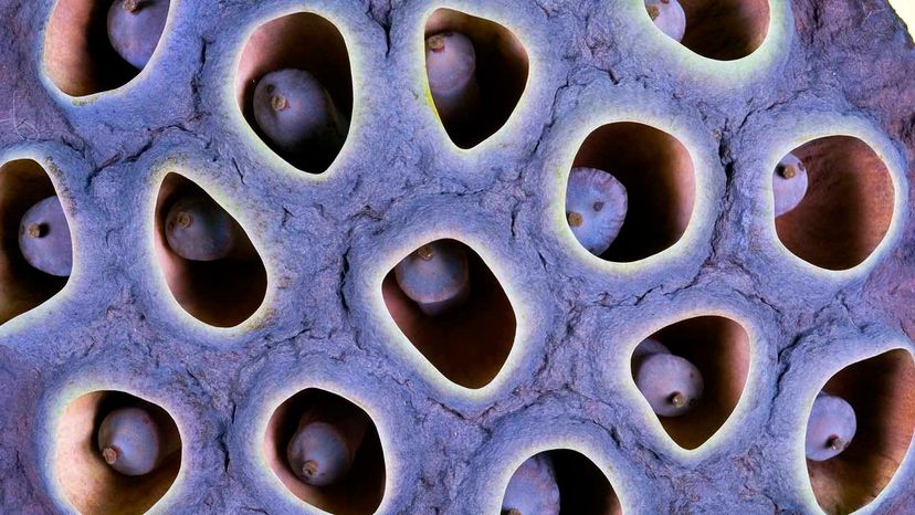 hole in people trypophobia disease