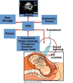 The parts of an ultrasound machine