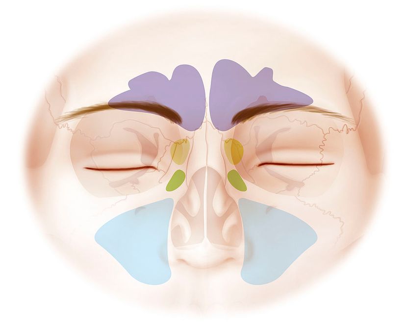 Understanding Sinus Congestion | HowStuffWorks