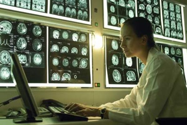 neuroscientist looking at brain scan