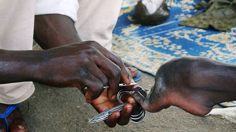 man with polio, Nigeria