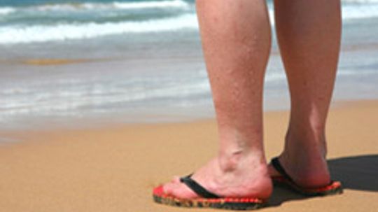 Fact or Fiction: Ultimate Varicose Veins