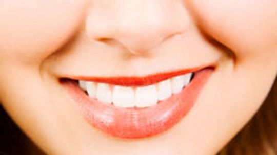 Flawless Fronts: Are teeth veneers right for you?