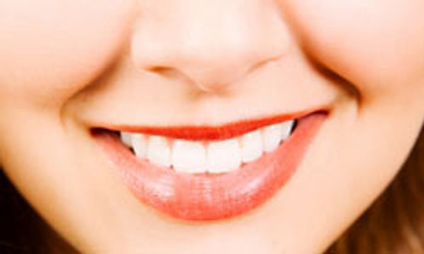Flawless Fronts: Are teeth veneers right for you?
