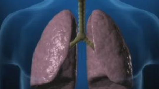 What is COPD?