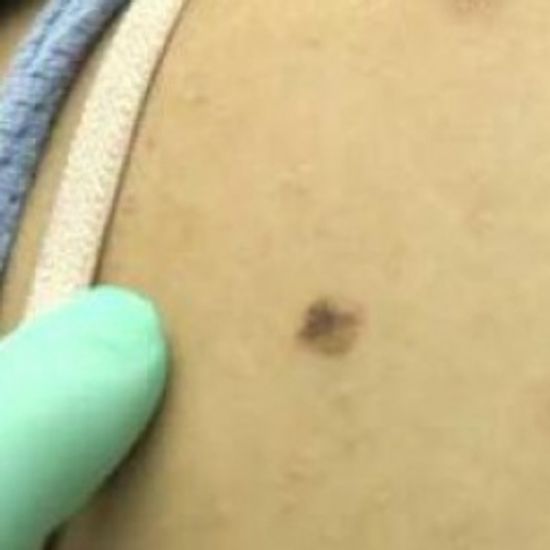 你有痣,看起来不?”class=