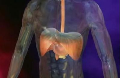 Human Atlas: Hiatal Hernia