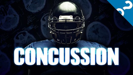 How Concussions Work: Knocked Out: Concussions in Contact Sports