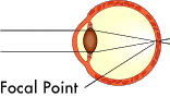 Figure 1: Light enters the eye and an image is focused on the retina.
