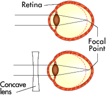 A Simple Way of Understanding How Vision Works