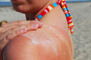 woman applying sunscreen to shoulder