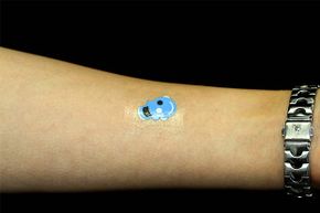 The Electrozyme temporary tattoo measures lactate, a chemical compound in sweat. That information can be used to monitor muscular exertion, fatigue, hydration levels and electrolyte balance.
