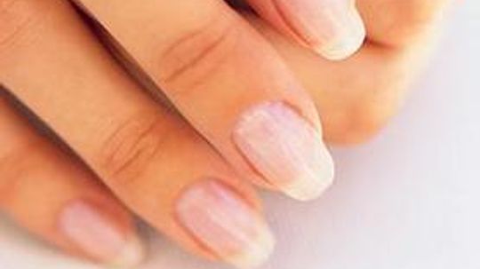 What Do Your Fingernails Say About Your Health?