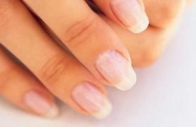 What do your fingernails look like?