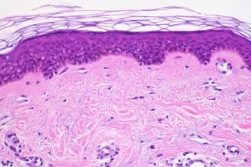Cross section of normal human skin taken with microscope. Hematoxylin and Eosin (H