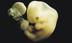 Pontocerebellar Hypoplasia is characterized by prenatal development of an abnormally small cerebellum and brain stem.