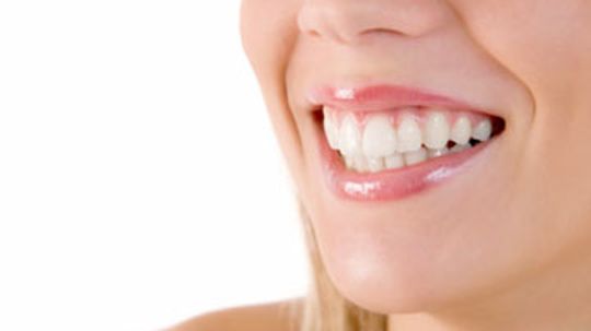 Do whitening strips damage your teeth?