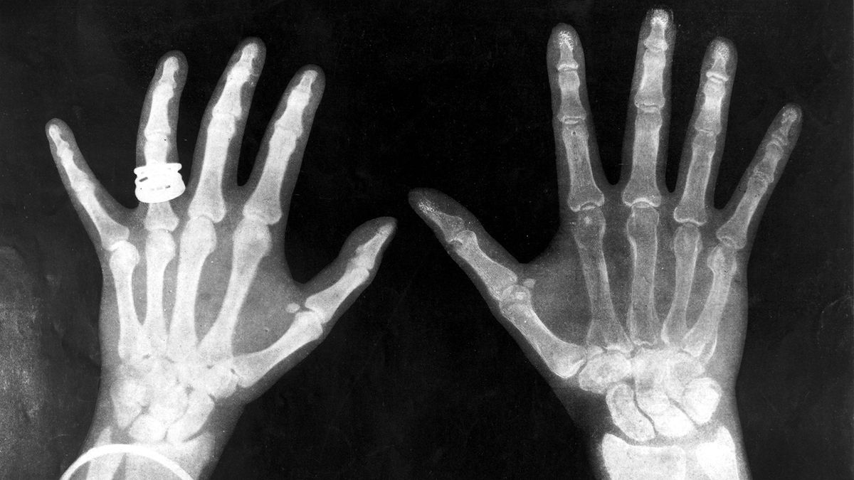 X-rays Work | HowStuffWorks