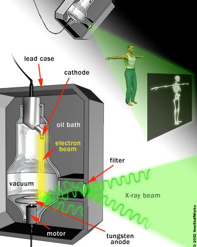 x ray machine diagram