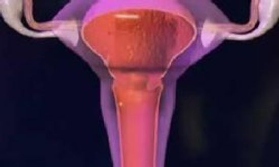 卵巢癌常识＂class=