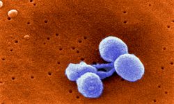 Streptococcus pneumoniae, as seen in a scanning electron micrograph.