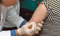 Dr. John Treanor uses a two-pronged needle to deliver the smallpox vaccine into the arm of a volunteer.