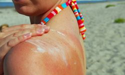 If you have sensitive skin or allergies, try different sunscreens with different ingredients until you find one that works best for your skin.