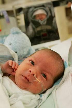 A baby born at 28 weeks in the NICU during a media tour for the March of Dimes' Prematurity Awareness Month at New York University Medical Center
