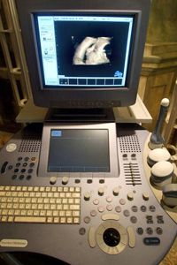GE's portable ultrasound equipment can be taken to the patient, rather than the other way around.