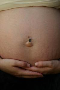 Stretch marks will fade dramatically, but for now, just think of them as emblems of that special club called Mothers.