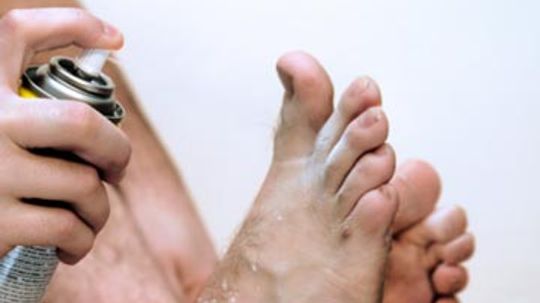 Quick Tips: 5 Home Remedies for Athlete's Foot