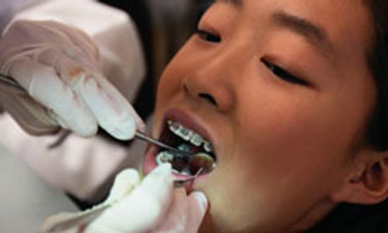 5 Teeth Straightening Options for Kids