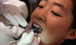 A few years of braces as a child is a small price to pay for a beautiful, healthy smile.