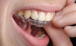 preteen boy wearing Invisalign