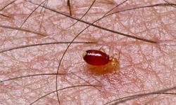 How do you prevent bedbugs from moving in? You really can't.